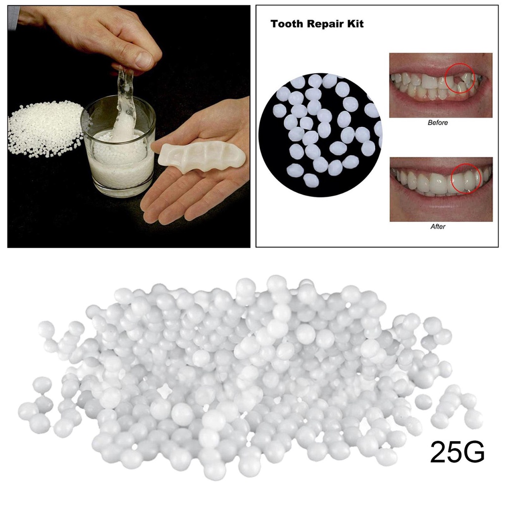 Thermal Beads Teeth Veneers Moldable Denture Temporary Tooth Repair 25g