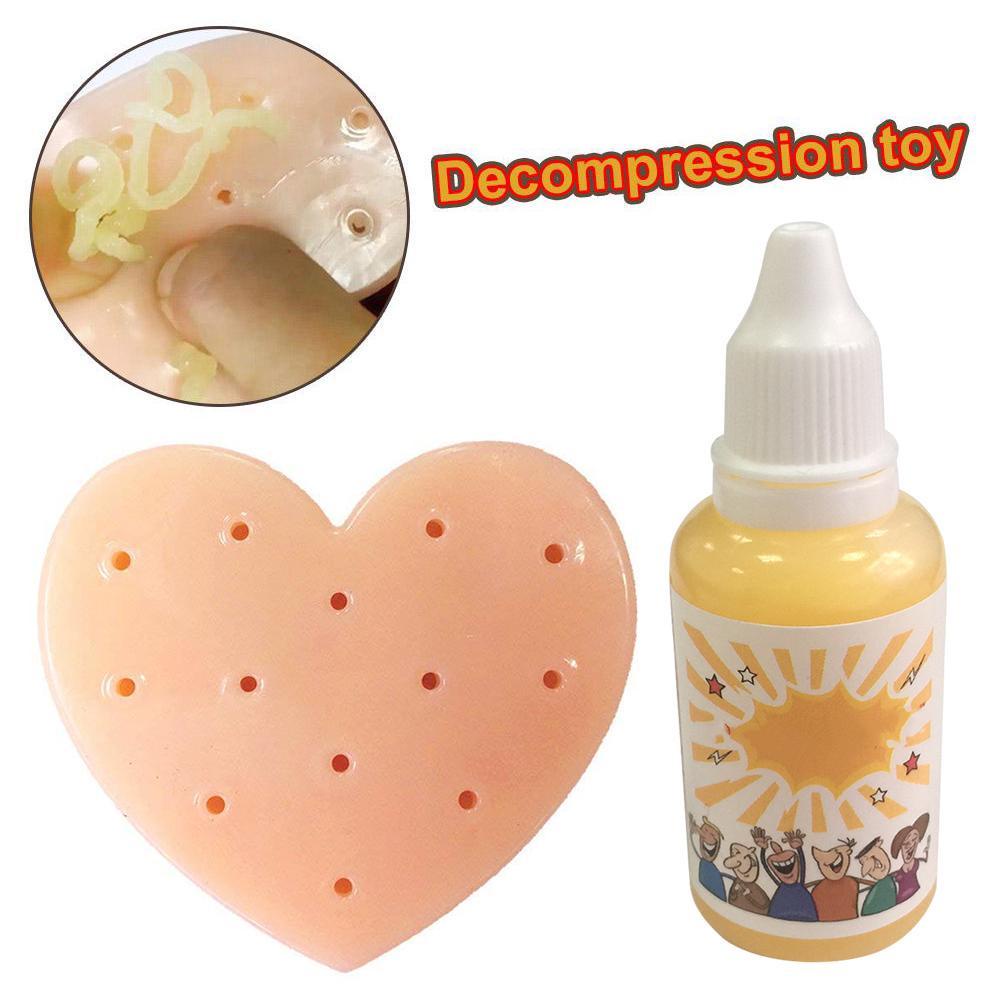 Acne Toys Squeeze Luminous Pimple Popping Popper Remover Stop Stress R3F9 